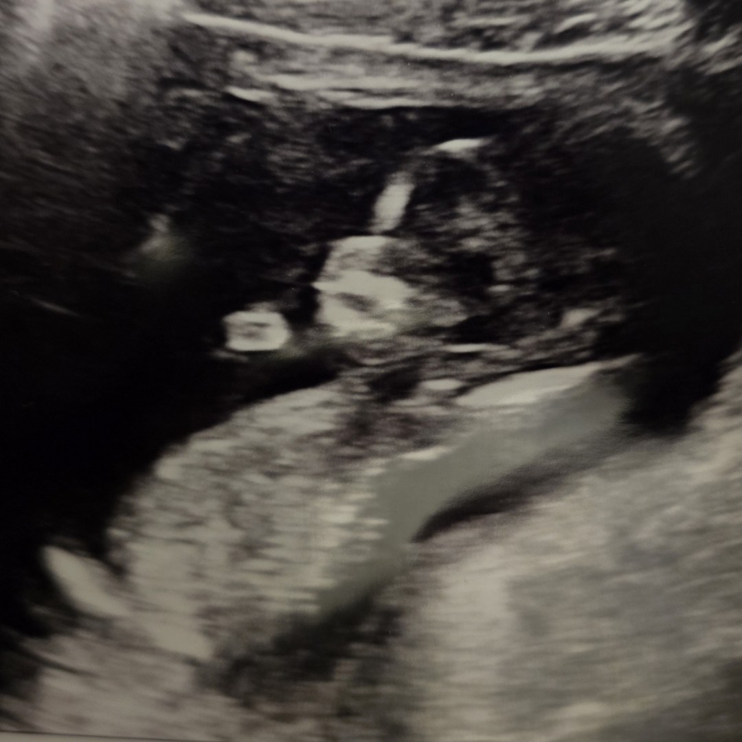 Photo shared by Reesiel for their Babylist baby registry.
