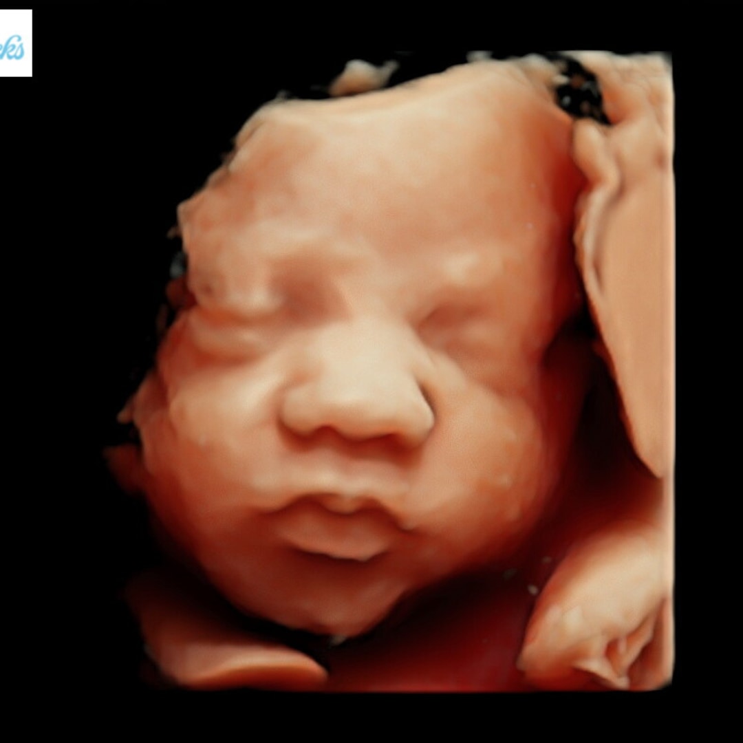 Photo shared by Jana for their Babylist baby registry.