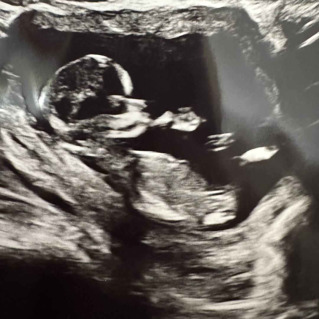 Photo shared by Colleen for their Babylist baby registry.