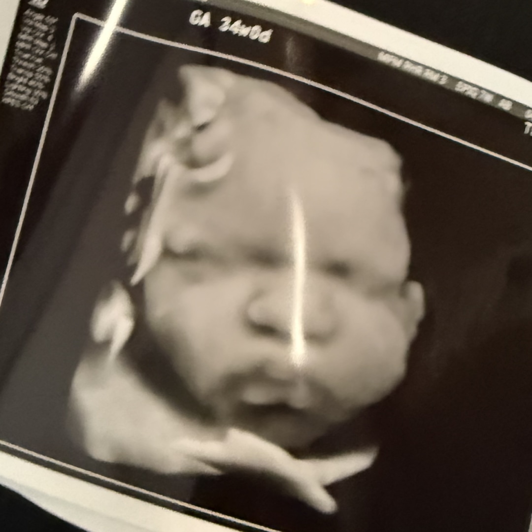 Photo shared by Doreen for their Babylist baby registry.