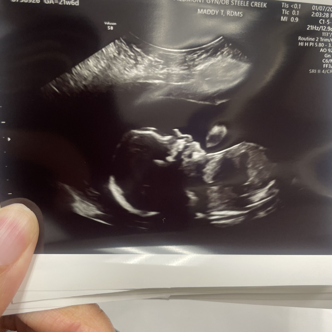 Photo shared by Nicole for their Babylist baby registry.