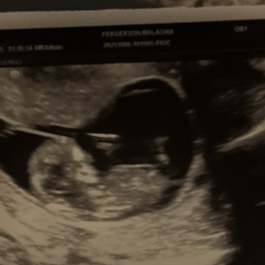 Photo shared by Malachia for their Babylist baby registry.