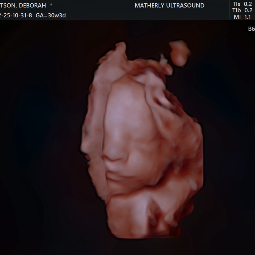 Photo shared by Deborah for their Babylist baby registry.