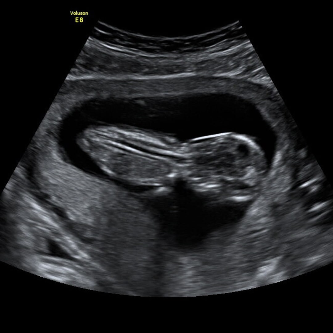 Photo shared by Cortney for their Babylist baby registry.