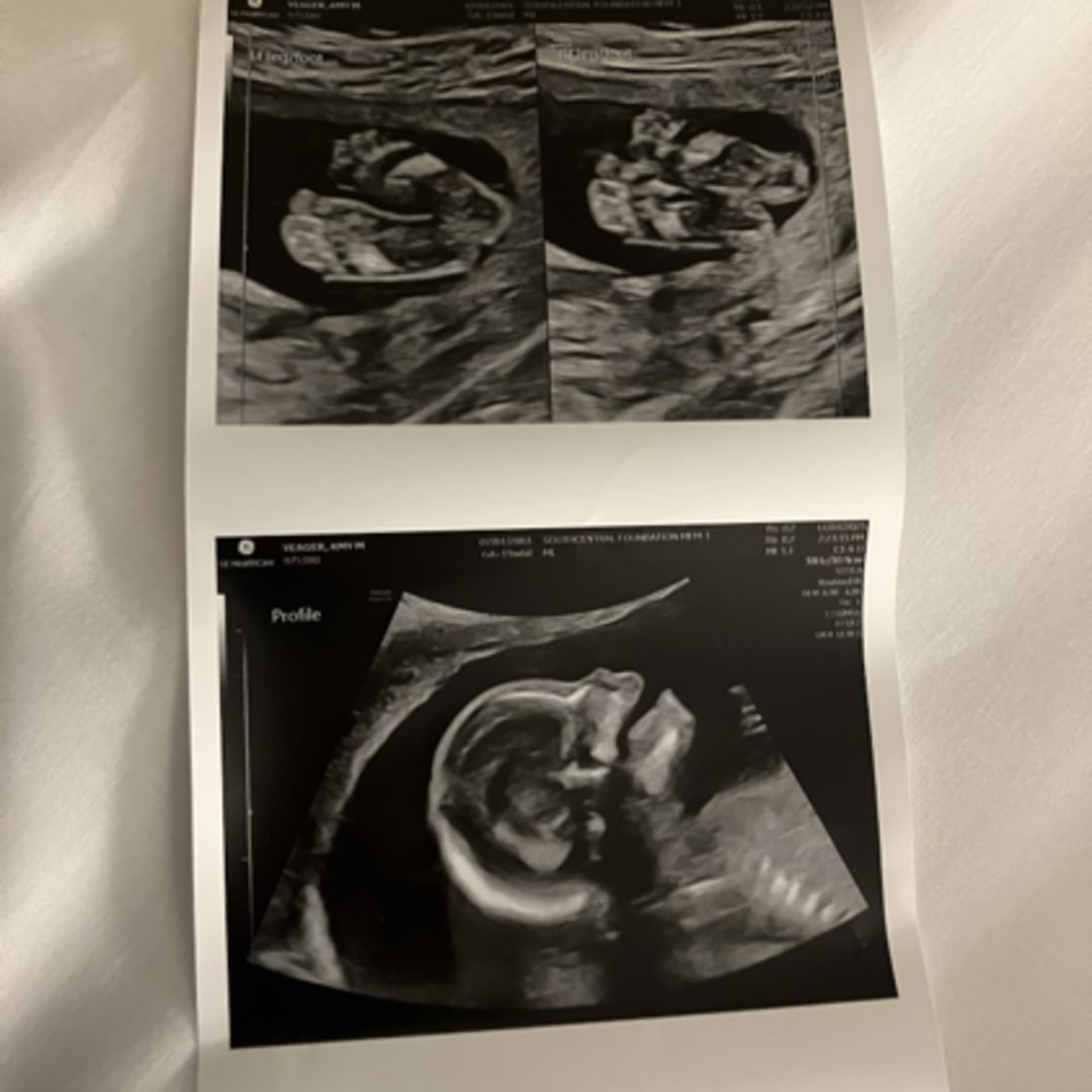 Photo shared by Amy for their Babylist baby registry.