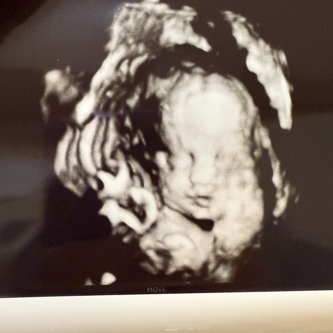 Photo shared by Kelli for their Babylist baby registry.