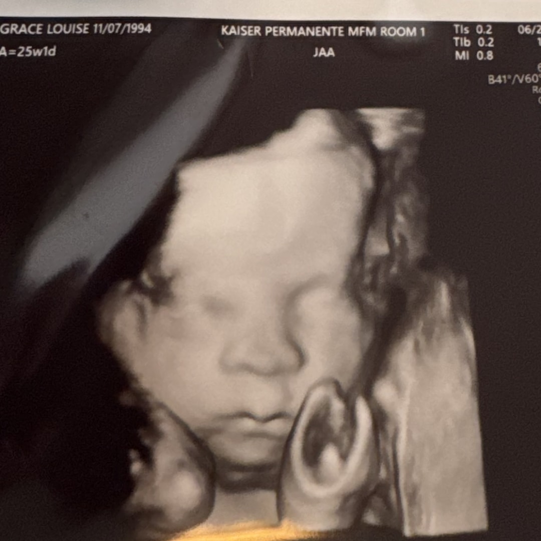 Photo shared by Grace for their Babylist baby registry.