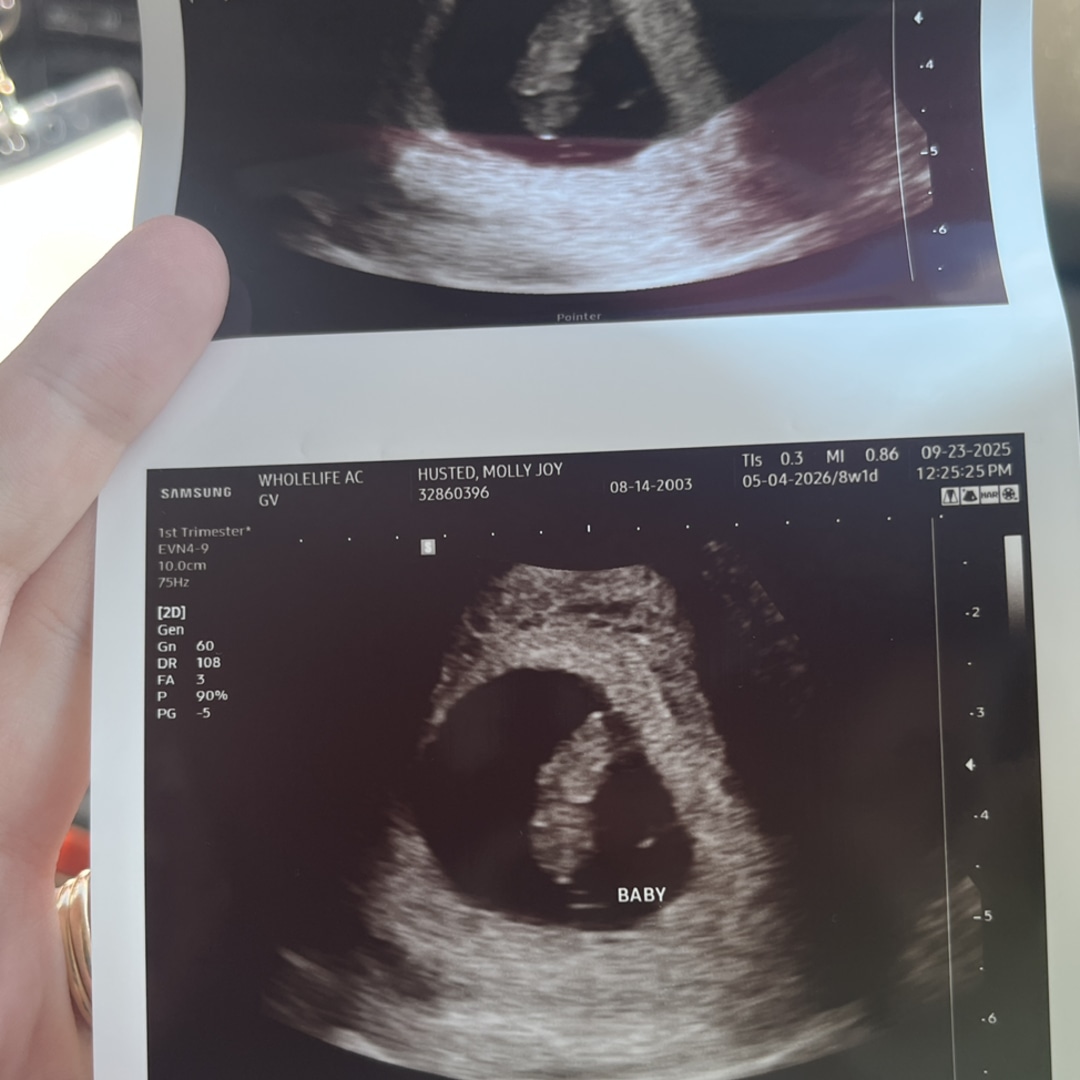 Photo shared by Molly for their Babylist baby registry.