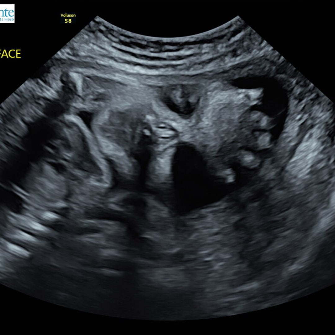 Photo shared by Celeste for their Babylist baby registry.