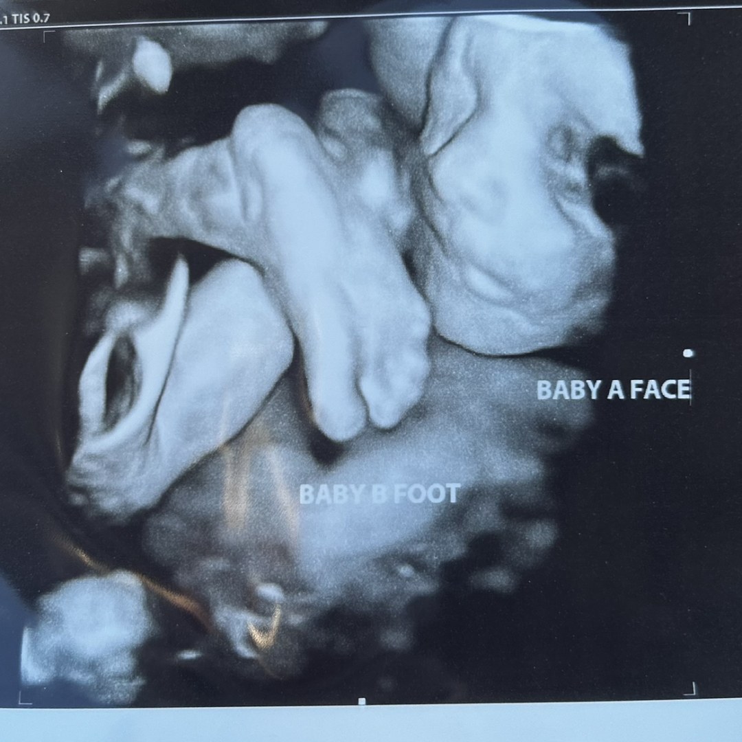 Photo shared by Brylee for their Babylist baby registry.