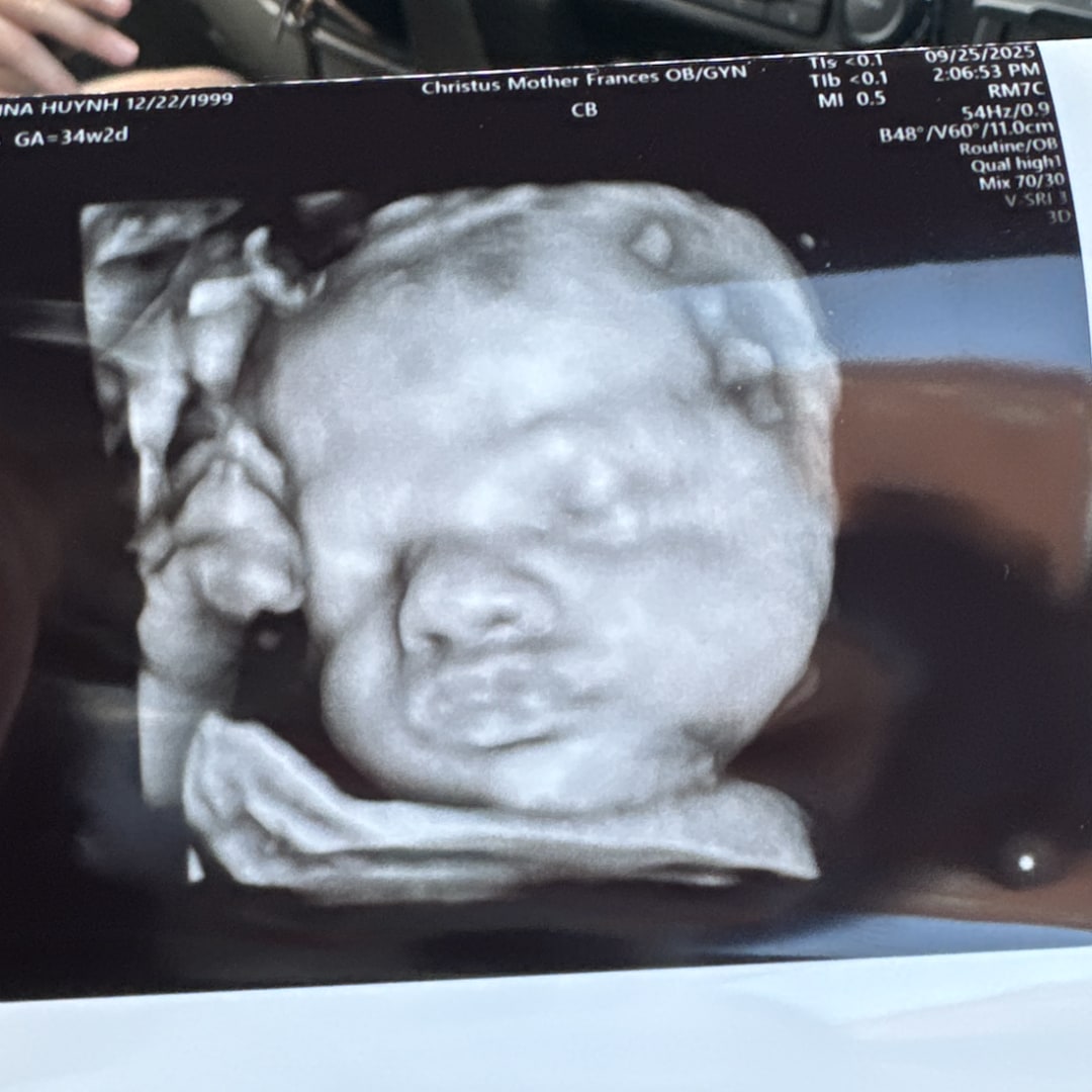 Photo shared by Anna for their Babylist baby registry.