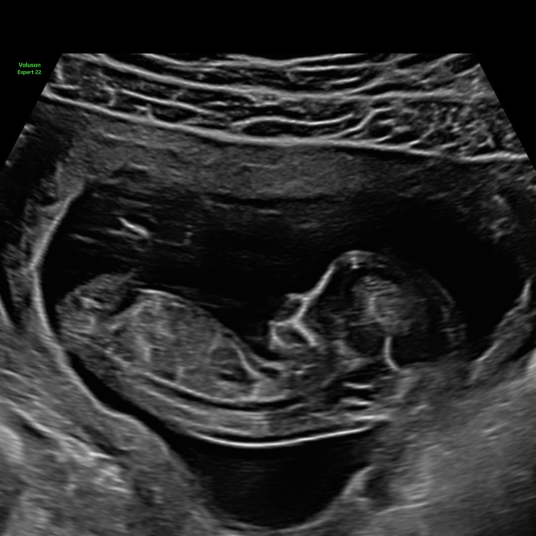 Photo shared by Rhea for their Babylist baby registry.