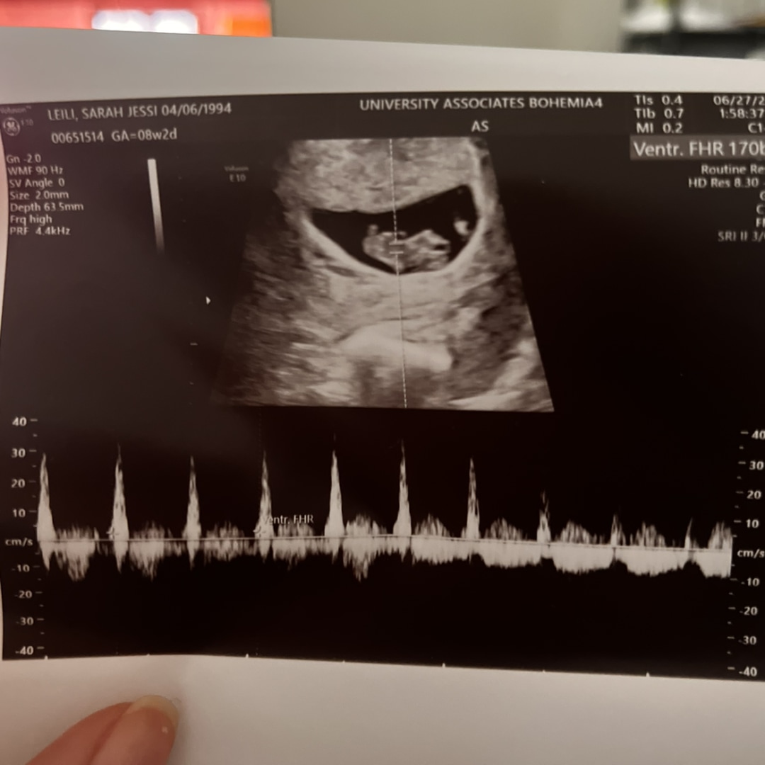 Photo shared by Sarah for their Babylist baby registry.