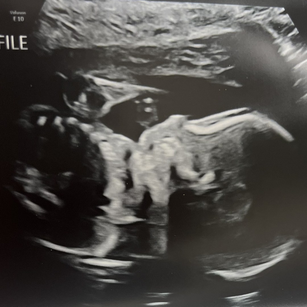 Photo shared by Brynn for their Babylist baby registry.
