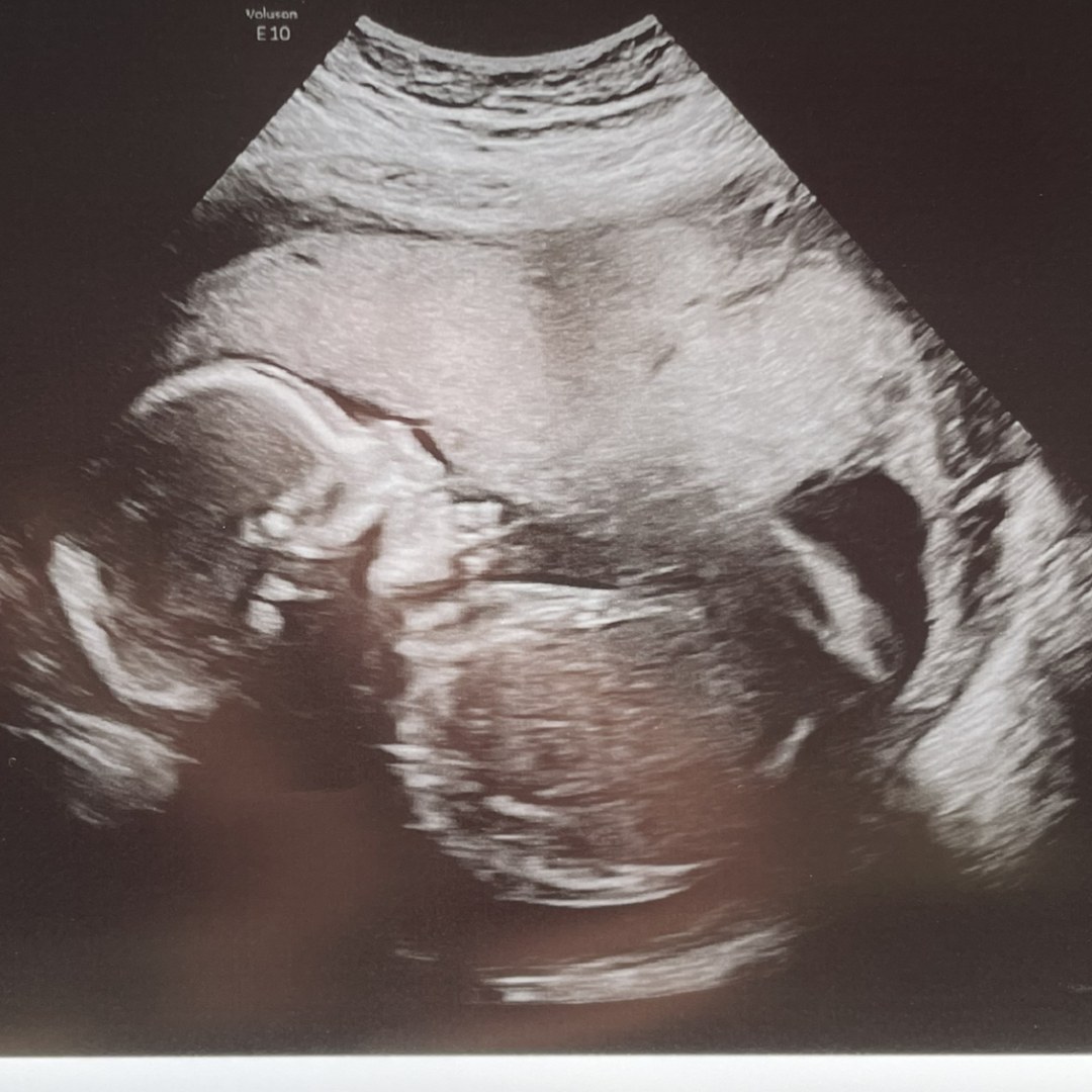 Photo shared by Jess for their Babylist baby registry.