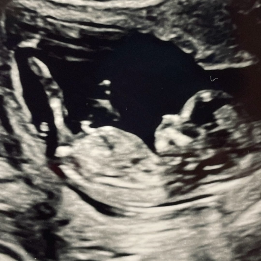 Photo shared by Cassidy for their Babylist baby registry.
