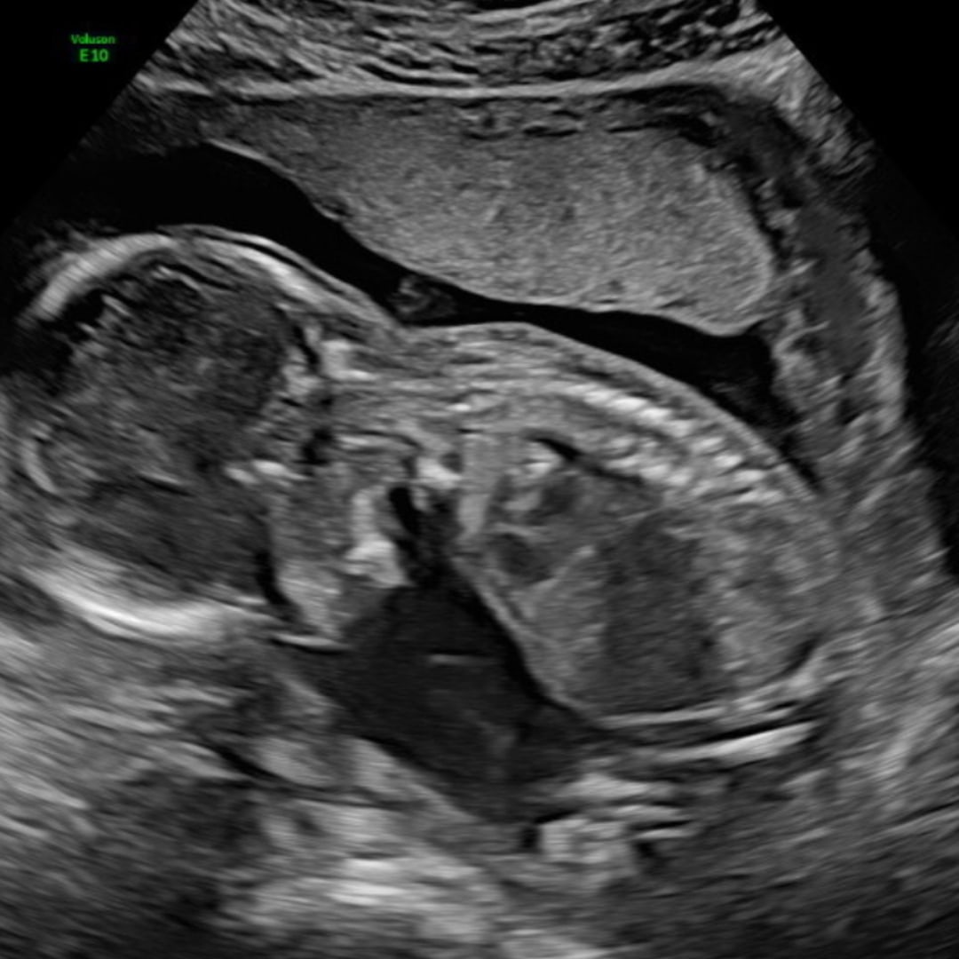 Photo shared by Christina for their Babylist baby registry.