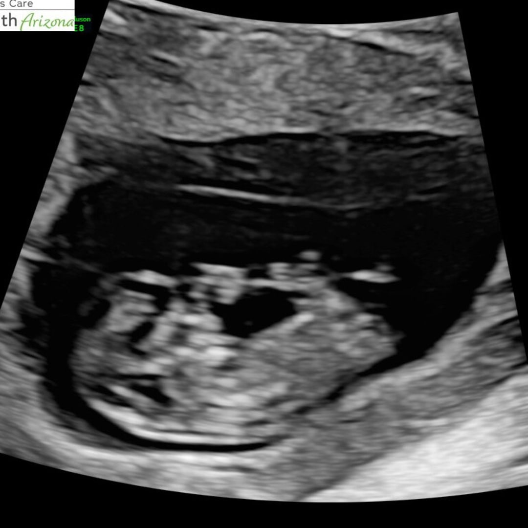Photo shared by Valerie for their Babylist baby registry.