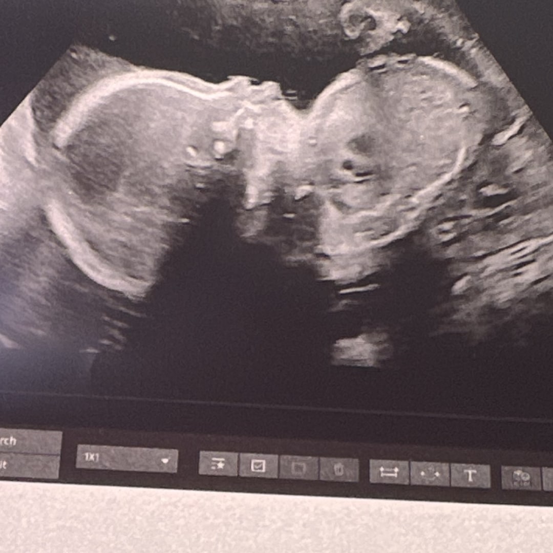 Photo shared by Shari for their Babylist baby registry.