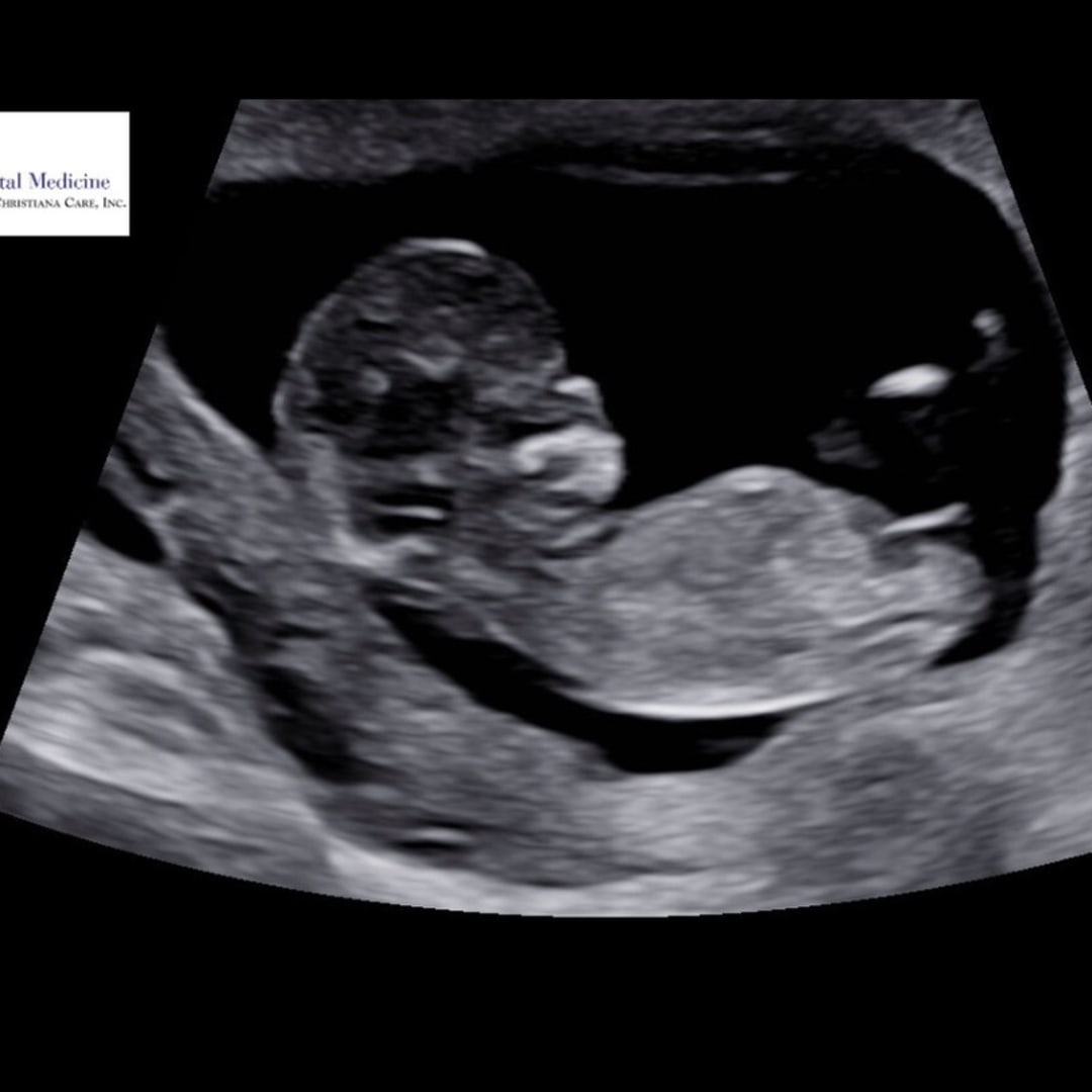 Photo shared by Madison for their Babylist baby registry.