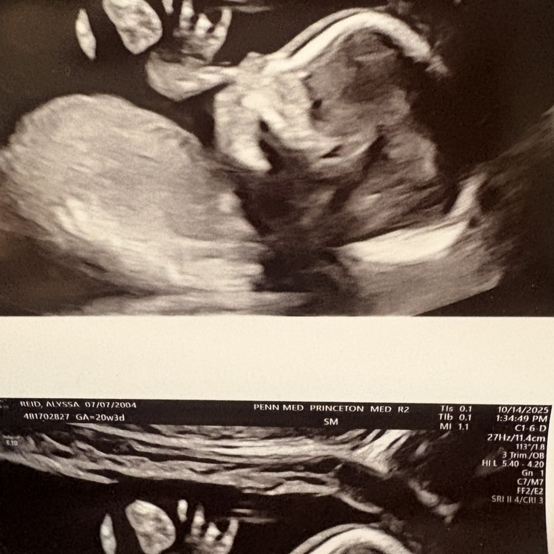 Photo shared by Alyssa for their Babylist baby registry.