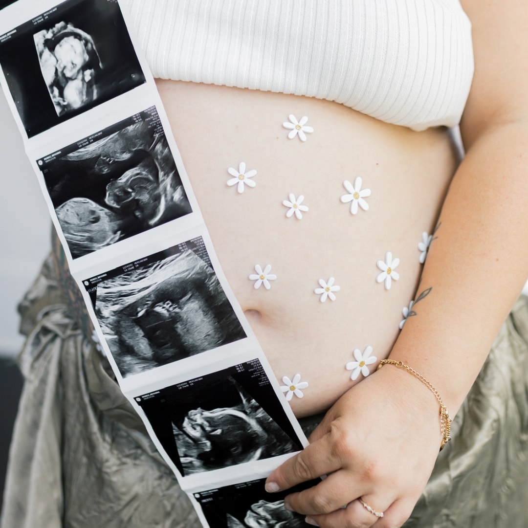 Photo shared by Bryanna & Anthony for their Babylist baby registry.