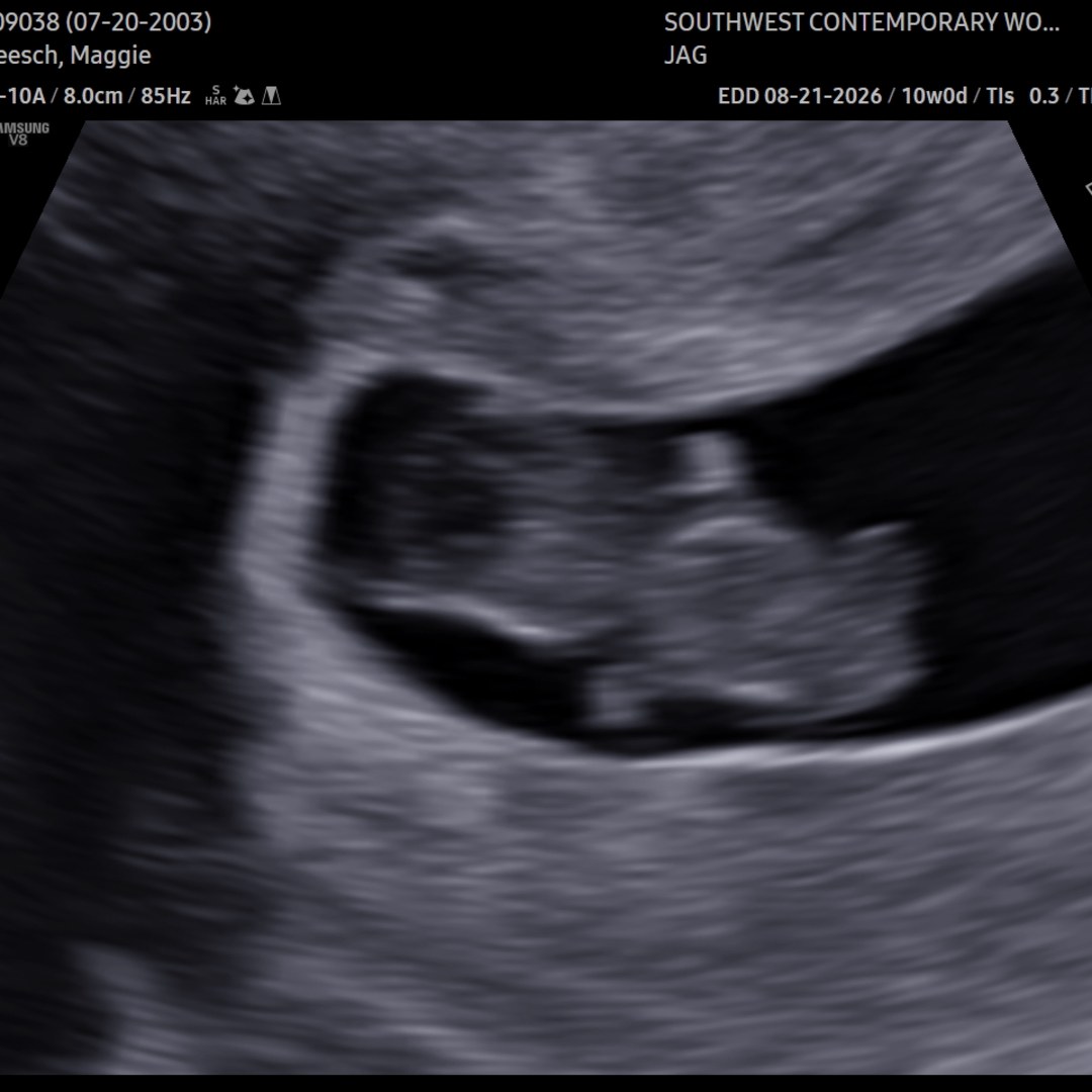 Photo shared by Maggie for their Babylist baby registry.