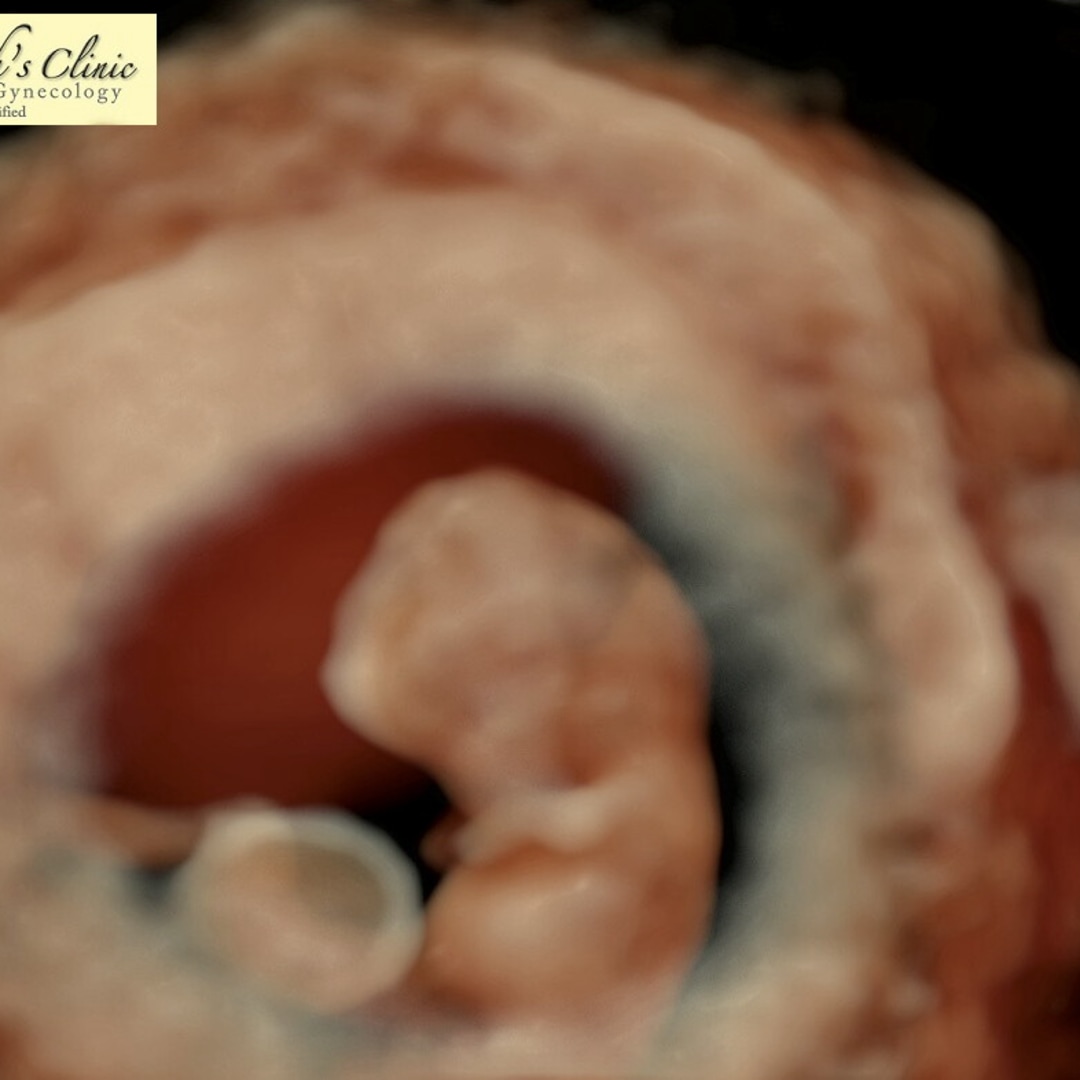 Photo shared by Mica Mae for their Babylist baby registry.