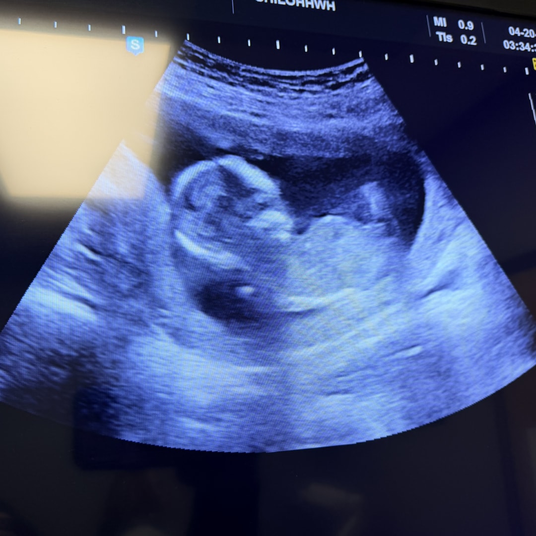 Photo shared by Aubree for their Babylist baby registry.