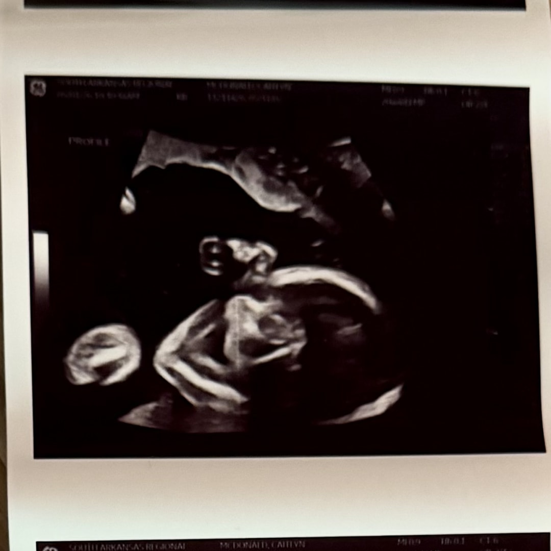 Photo shared by Caitlyn for their Babylist baby registry.