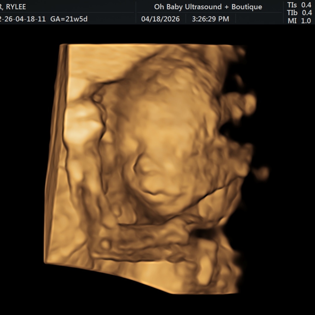 Photo shared by Rylee for their Babylist baby registry.