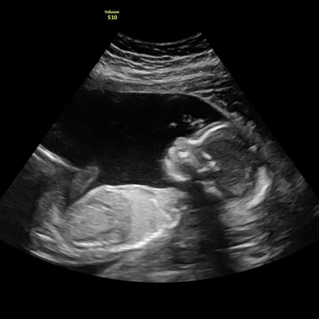 Photo shared by Audrey for their Babylist baby registry.