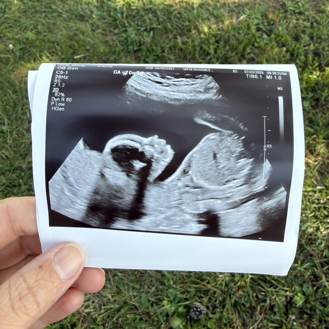 Photo shared by Abigail for their Babylist baby registry.