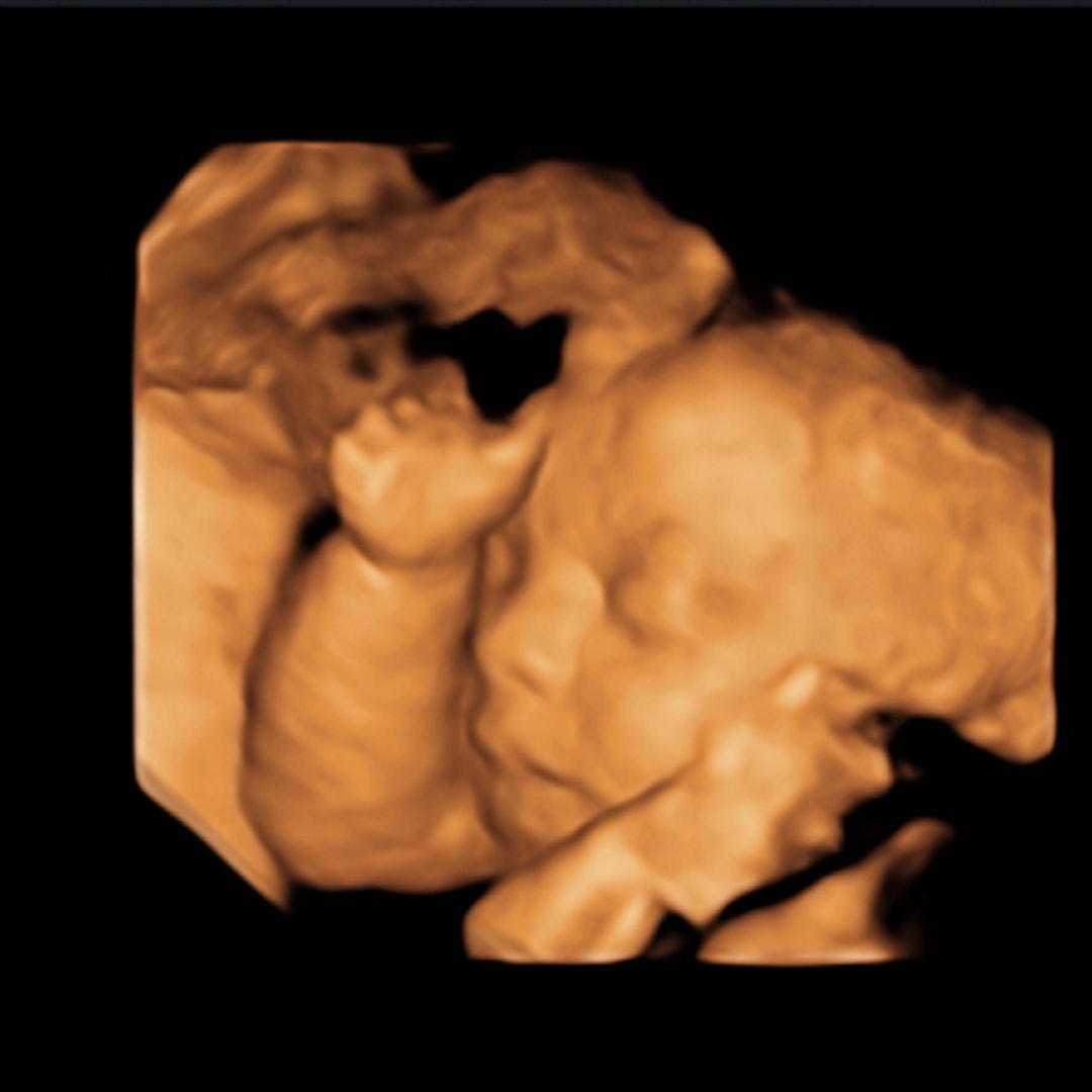 Photo shared by Alea for their Babylist baby registry.