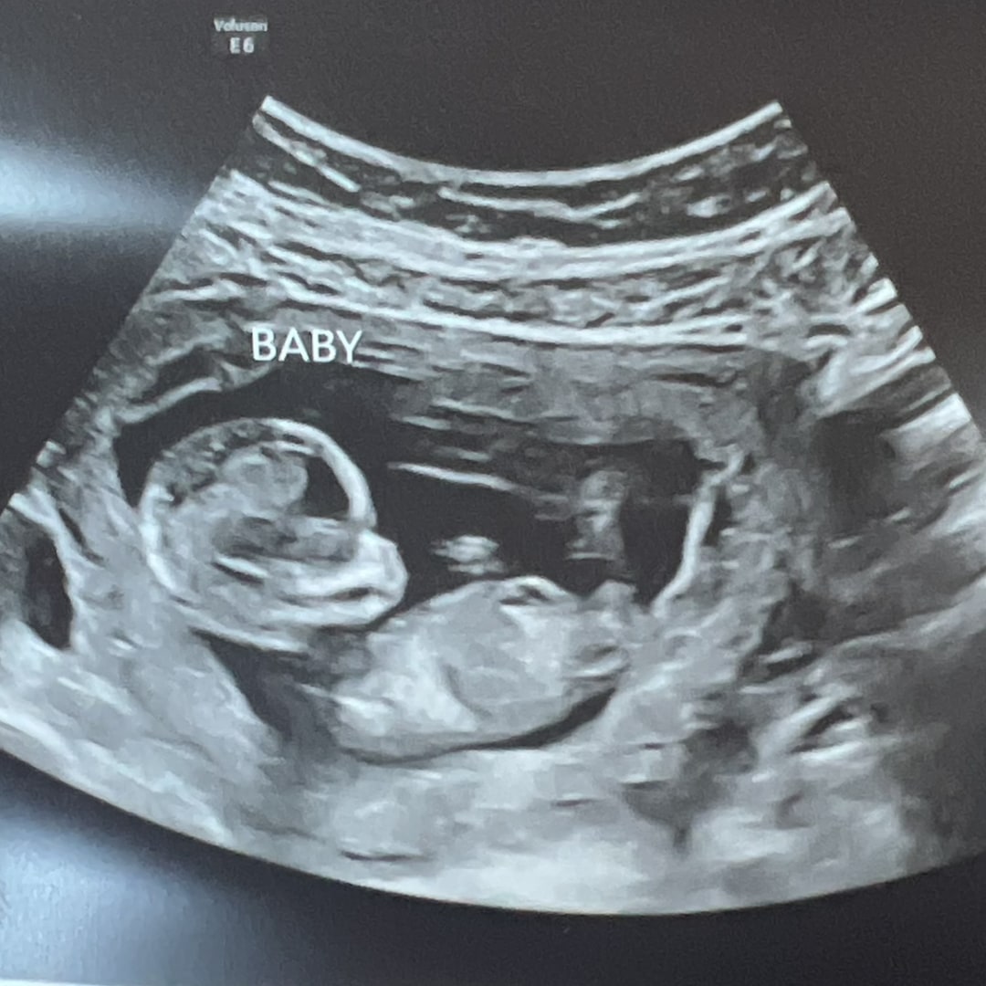 Photo shared by Jordan for their Babylist baby registry.