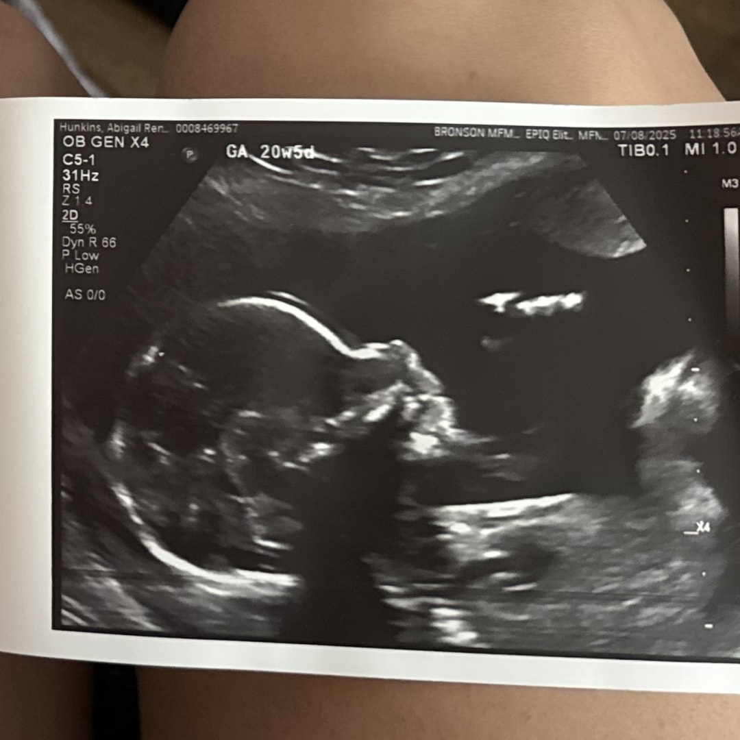 Photo shared by Abigail for their Babylist baby registry.