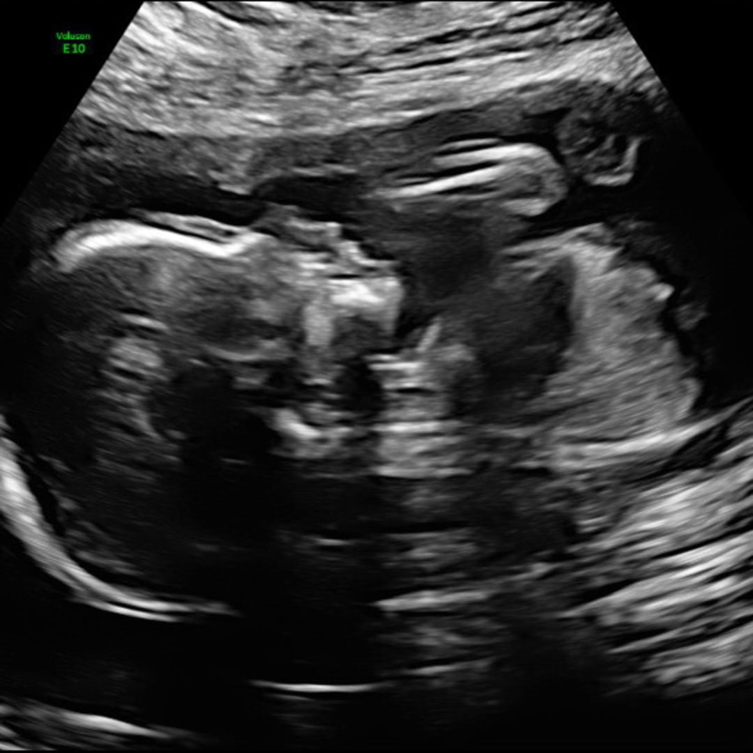 Photo shared by Brittani for their Babylist baby registry.