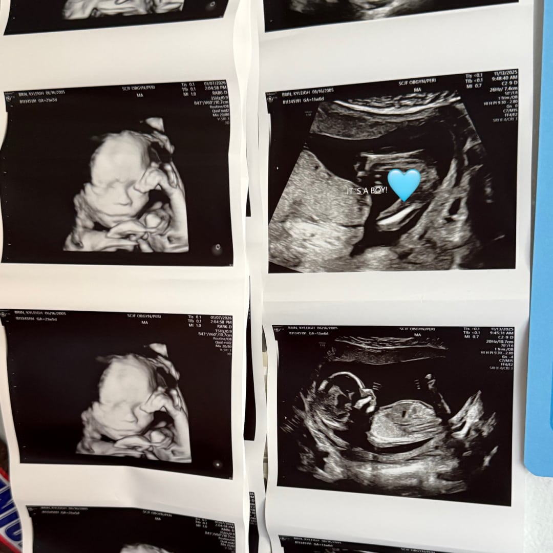 Photo shared by Kyleigh for their Babylist baby registry.