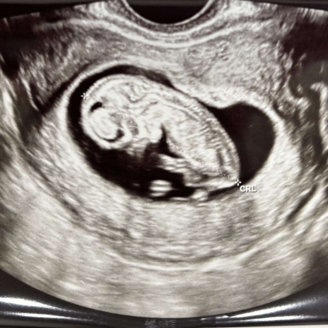 Photo shared by Adam for their Babylist baby registry.