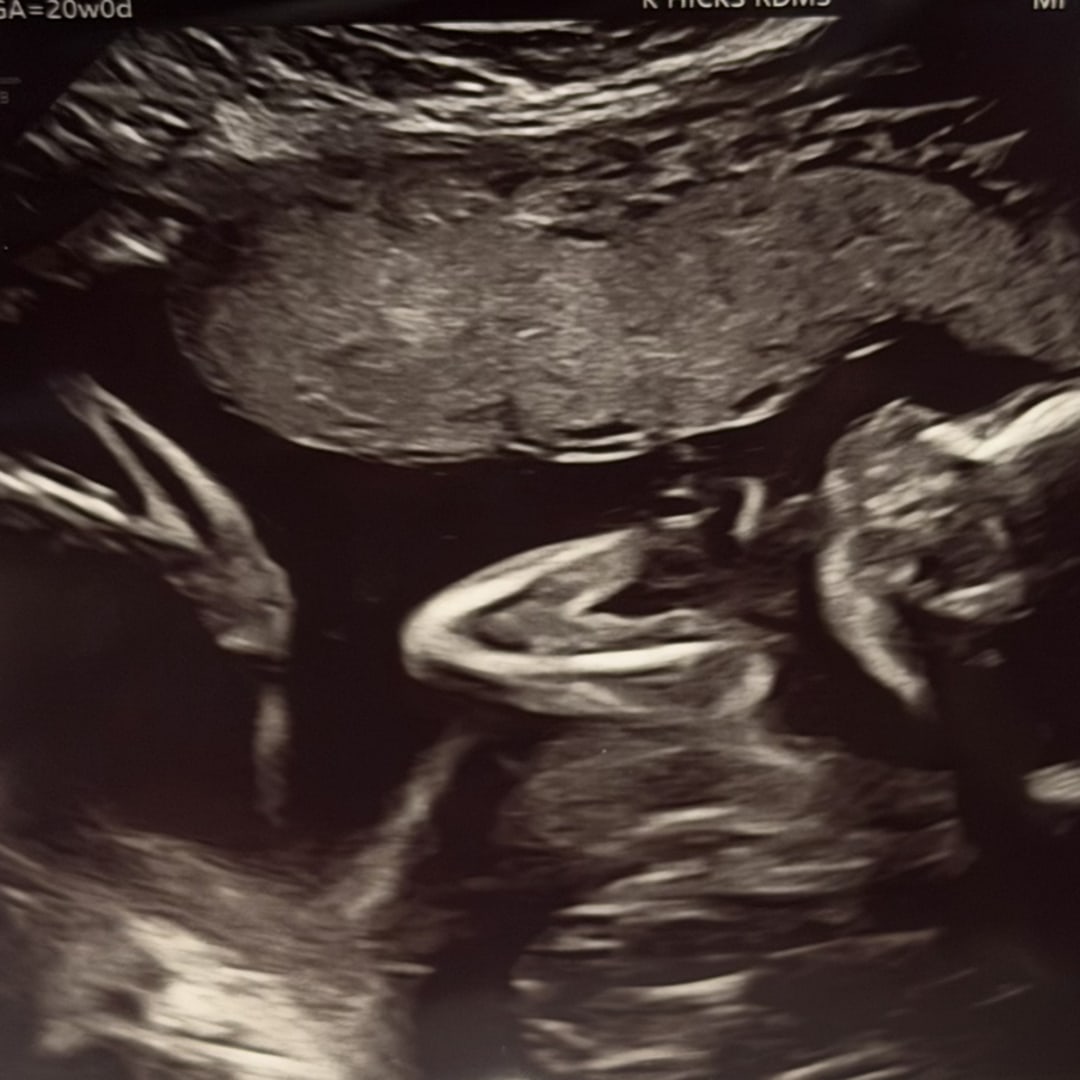 Photo shared by Gabriela for their Babylist baby registry.