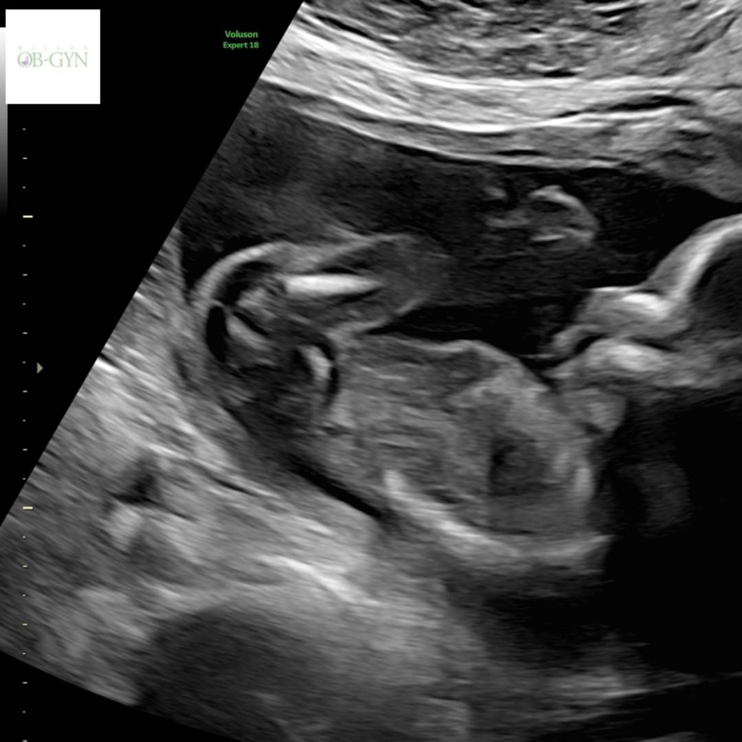 Photo shared by A'Sierra for their Babylist baby registry.