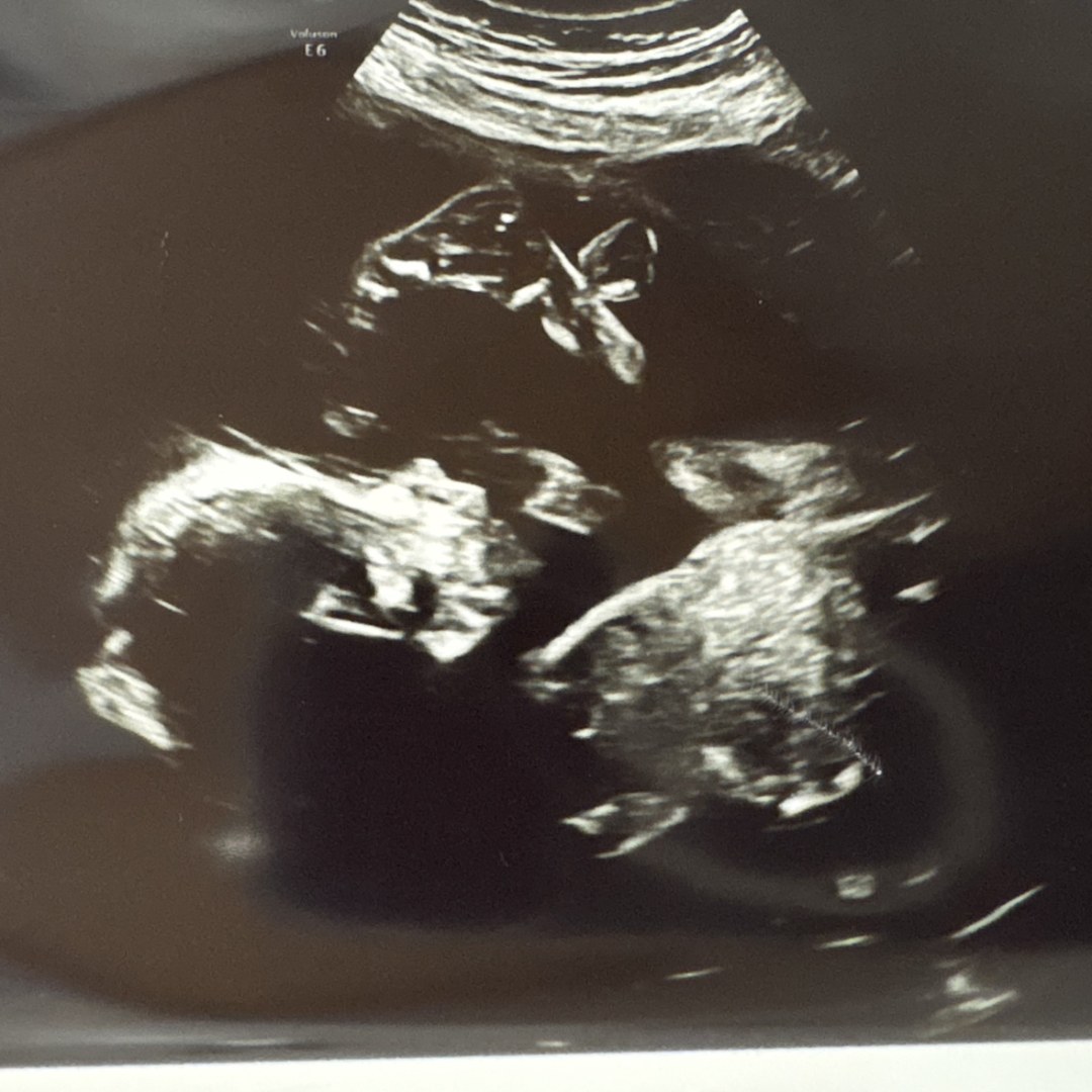 Photo shared by Erica for their Babylist baby registry.