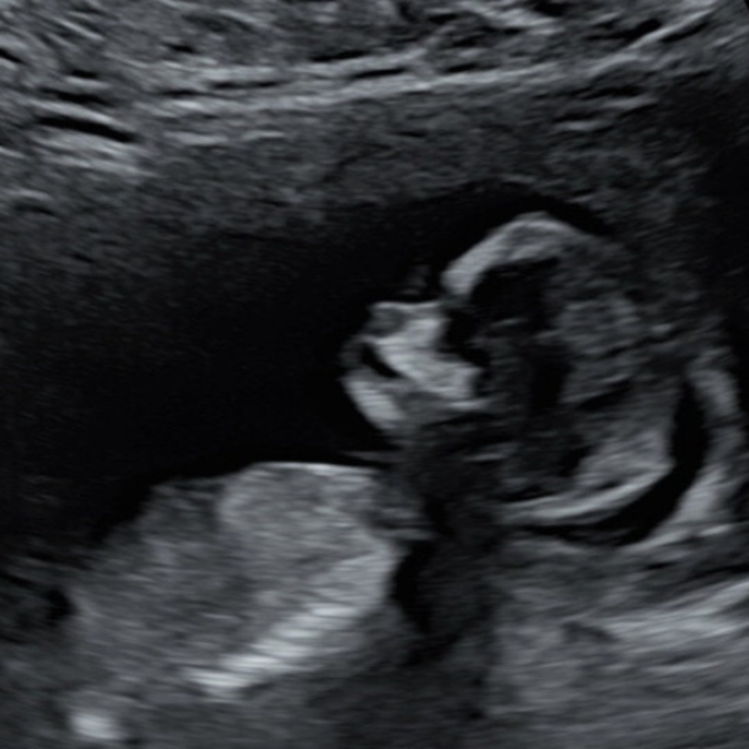 Photo shared by Annamarie for their Babylist baby registry.