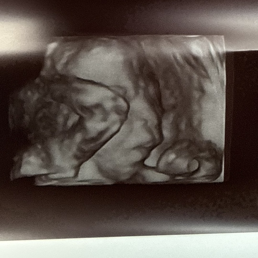 Photo shared by Morgan for their Babylist baby registry.