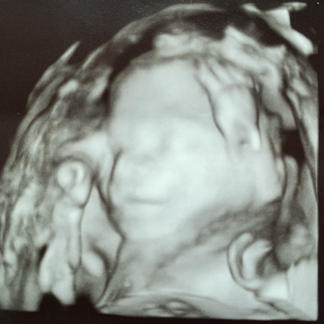 Photo shared by Cerissa for their Babylist baby registry.