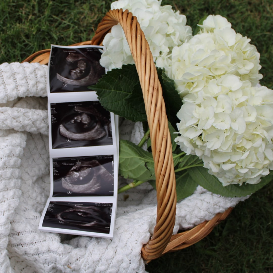Photo shared by Jenna for their Babylist baby registry.