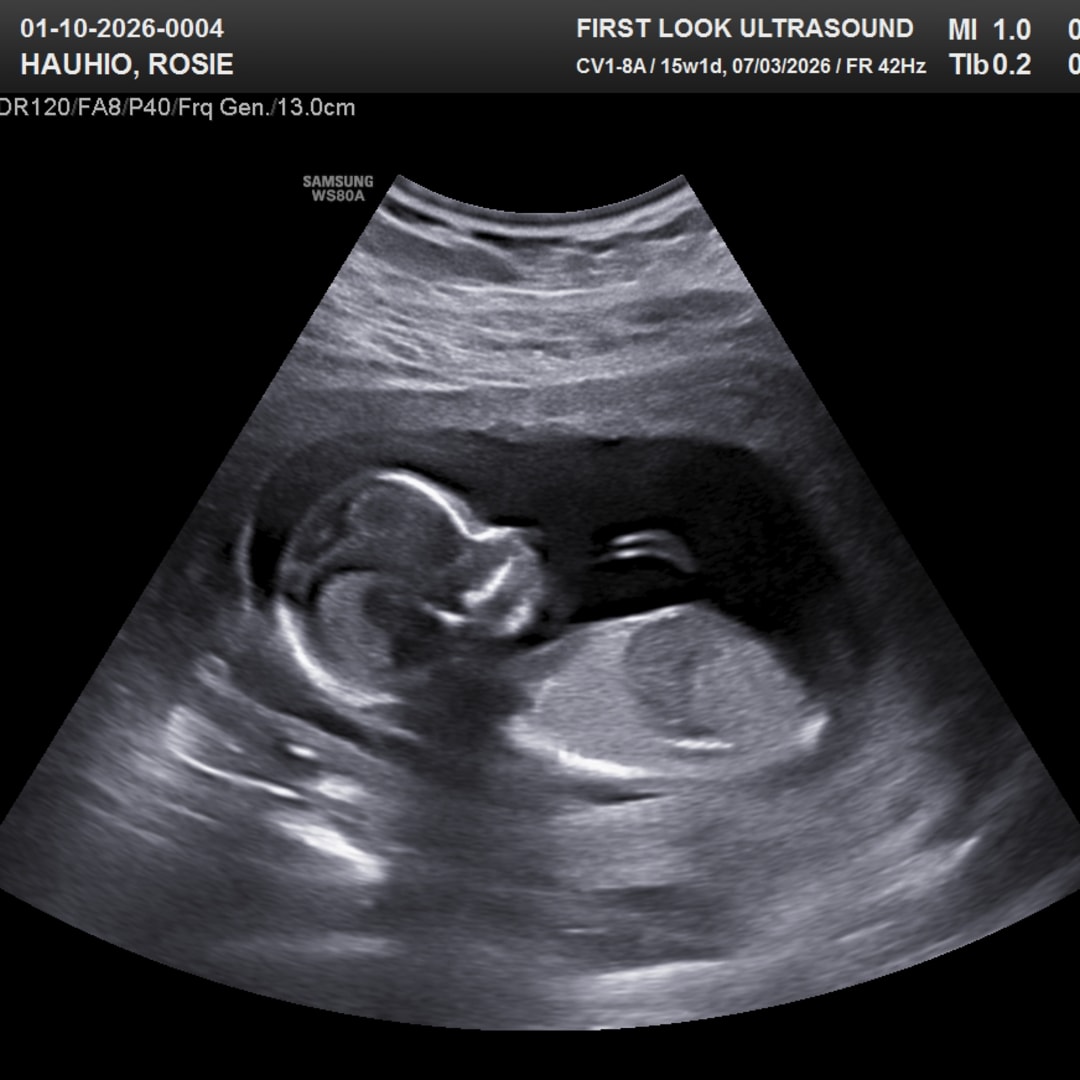 Photo shared by Rosie for their Babylist baby registry.