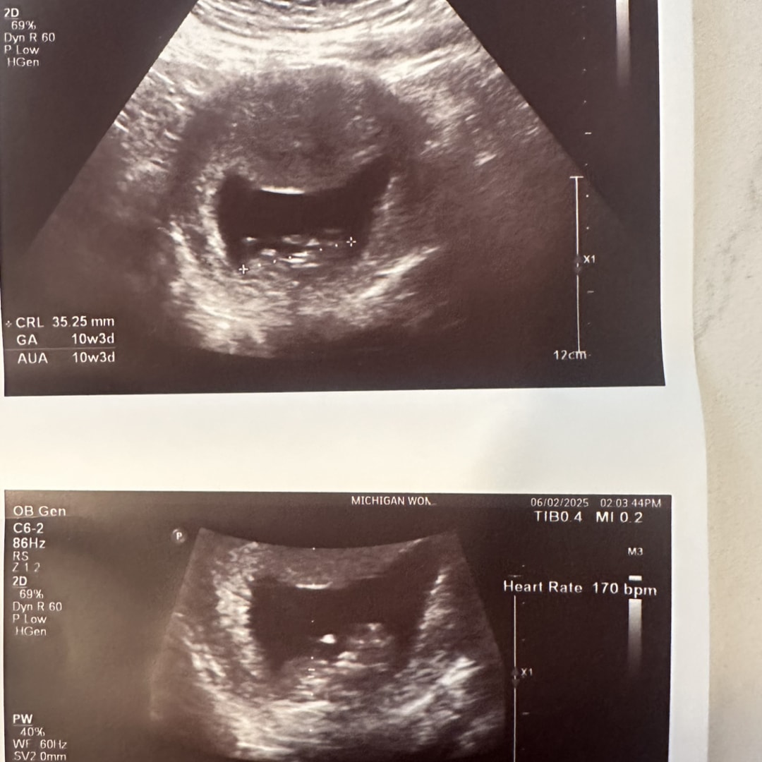 Photo shared by Emily for their Babylist baby registry.