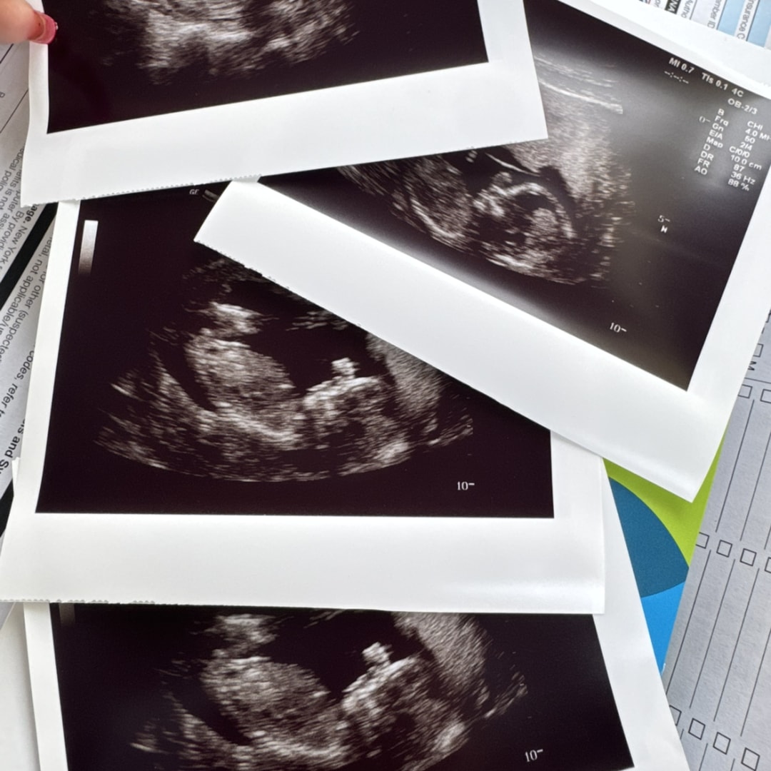 Photo shared by Cassie for their Babylist baby registry.