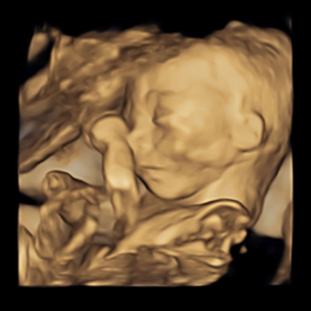 Photo shared by Lindsey for their Babylist baby registry.